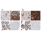 Immunohistochemical staining of human cerebral cortex, pancreas, placenta and skeletal muscle using Anti-SND1 antibody HPA002632 (A) shows similar protein distribution across tissues to independent antibody HPA002529 (B).