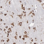 Immunohistochemical staining of human cerebral cortex shows strong cytoplasmic positivity in neurons.
