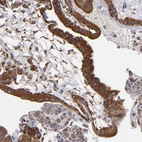 Immunohistochemical staining of human placenta shows strong cytoplasmic positivity in trophoblastic cells.