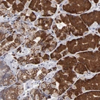 Immunohistochemical staining of human stomach shows strong cytoplasmic positivity in glandular cells.