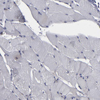 Immunohistochemical staining of human skeletal muscle shows no positivity in myocytes as expected.