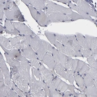 Immunohistochemical staining of human skeletal muscle shows no positivity in myocytes as expected.