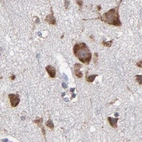 Immunohistochemical staining of human cerebral cortex using Anti-SND1 antibody HPA002632.