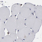 Immunohistochemical staining of human skeletal muscle using Anti-SND1 antibody HPA002632.
