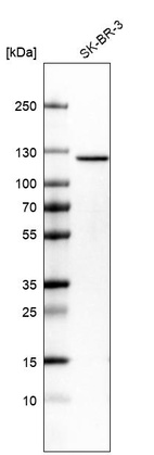 Western blot analysis in human cell line SK-BR-3.