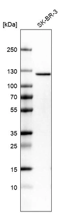 Western blot analysis in human cell line SK-BR-3.