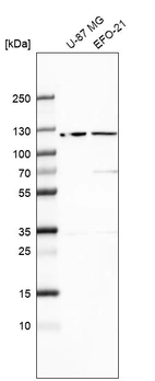 Western blot analysis in human cell line U-87 MG and human cell line EFO-21.
