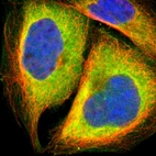 Immunofluorescent staining of human cell line A-431 shows localization to cytosol.