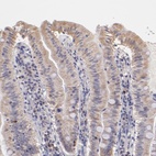 Anti-RNASEL Antibody