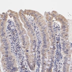 Anti-RNASEL Antibody