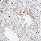 Anti-AURKA Antibody