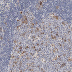 Immunohistochemical staining of human lymph node shows weak to moderate cytoplasmic positivity in germinal center cells.