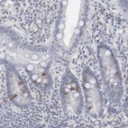 Immunohistochemical staining of human duodenum shows weak to moderate cytoplasmic positivity in a subset of glandular cells.