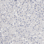 Immunohistochemical staining of human liver shows no positivity in hepatocytes as expected.