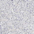 Anti-AURKA Antibody