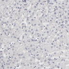 Immunohistochemical staining of human liver shows no positivity in hepatocytes as expected.