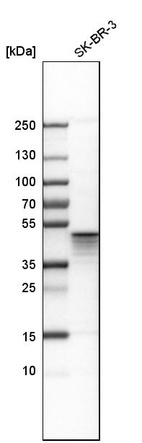 Western blot analysis in human cell line SK-BR-3.