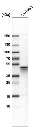 Western blot analysis in human cell line SK-BR-3.