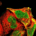 Immunofluorescent staining of human cell line A-431 shows localization to nucleus, cytosol & centrosome.