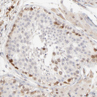 Anti-CDK6 Antibody