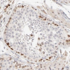 Immunohistochemical staining of human testis shows moderate nuclear positivity in cells in seminiferous ducts.