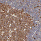 Anti-CDK6 Antibody