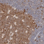 Immunohistochemical staining of human lymph node shows moderate to strong cytoplasmic positivity in germinal center cells.