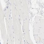 Anti-CDK6 Antibody