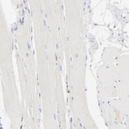 Immunohistochemical staining of human skeletal muscle shows no positivity in myocytes as expected.