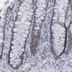 Anti-RAF1 Antibody