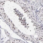 Immunohistochemical staining of human testis shows weak positivity in nuclear speckles in cells in seminiferous ducts.