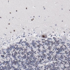 Immunohistochemical staining of human cerebellum shows moderate positivity in nuclear speckles in Purkinje cells.
