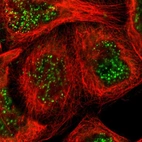 Immunofluorescent staining of human cell line A-431 shows localization to nuclear speckles.