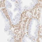 Immunohistochemical staining of human prostate shows moderate membranous positivity in smooth muscle cells.