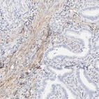 Immunohistochemical staining of human endometrium shows weak to moderate membranous positivity in smooth muscle cells.