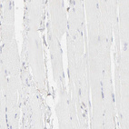 Immunohistochemical staining of human skeletal muscle shows no positivity in myocytes as expected.
