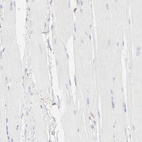 Anti-ITGA5 Antibody