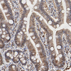 Immunohistochemical staining of human appendix shows moderate to strong cytoplasmic positivity in glandular cells.