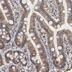 Immunohistochemical staining of human appendix shows moderate to strong cytoplasmic positivity in glandular cells.