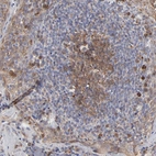 Immunohistochemical staining of human lymph node shows moderate to strong cytoplasmic positivity in germinal center cells.