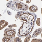 Immunohistochemical staining of human placenta shows weak to moderate cytoplasmic positivity in trophoblastic cells.
