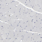 Immunohistochemical staining of human skeletal muscle shows no cytoplasmic positivity in myocytes as expected.