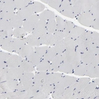 Immunohistochemical staining of human skeletal muscle shows no cytoplasmic positivity in myocytes as expected.