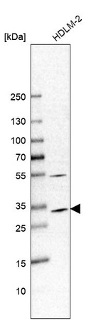 Western blot analysis in human cell line HDLM-2.