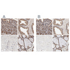 Anti-PDIA3 Antibody