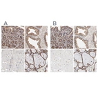 Immunohistochemical staining of human gastrointestinal, prostate, skeletal muscle and thyroid gland using Anti-PDIA3 antibody HPA002645 (A) shows similar protein distribution across tissues to independent antibody HPA003230 (B).