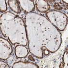 Immunohistochemical staining of human thyroid gland shows strong cytoplasmic positivity in glandular cells.