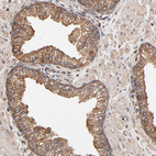 Anti-PDIA3 Antibody