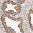 Immunohistochemical staining of human prostate shows moderate cytoplasmic positivity in glandular cells.