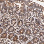 Immunohistochemical staining of human small intestine shows moderate to strong cytoplasmic positivity in glandular cells.